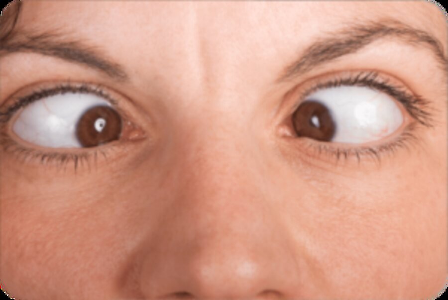 Cornea & Anterior Segment