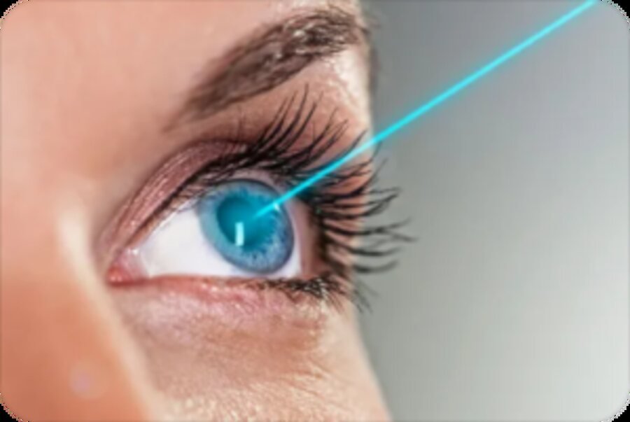 Refractive Surgery